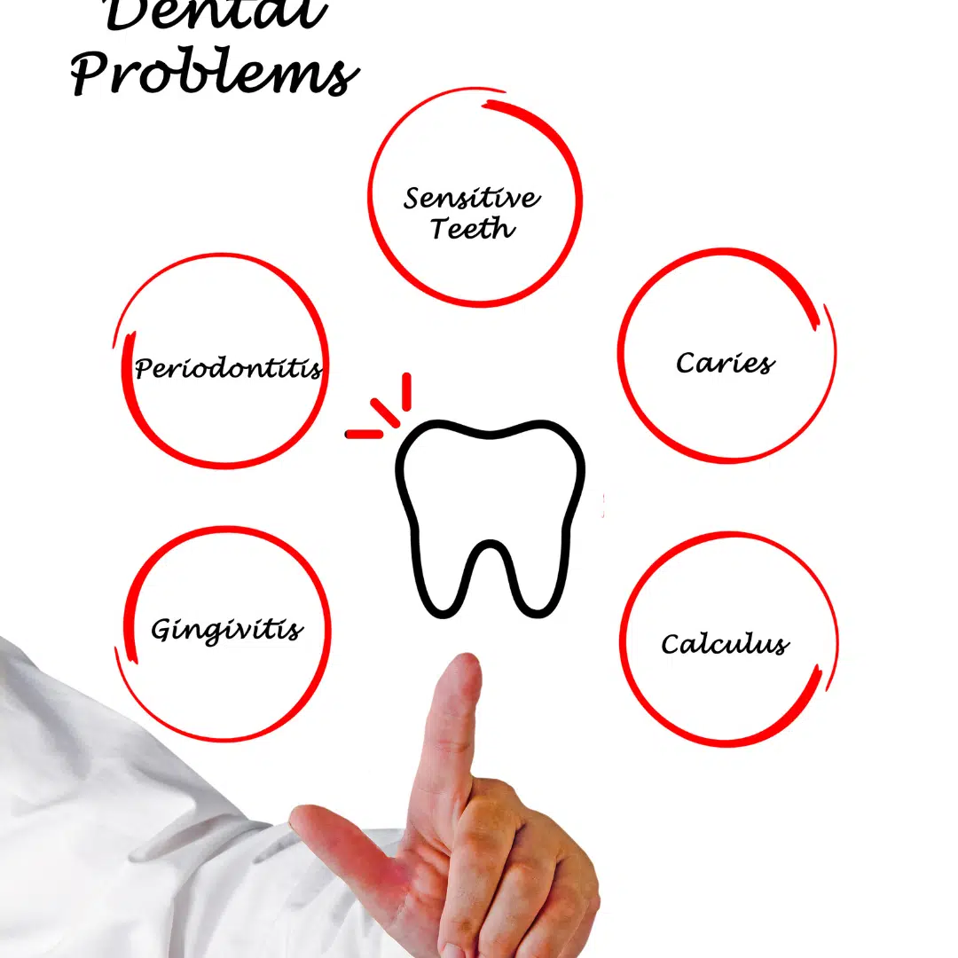 dental-problem