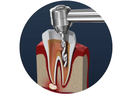 Bright-smile-dental-clinic