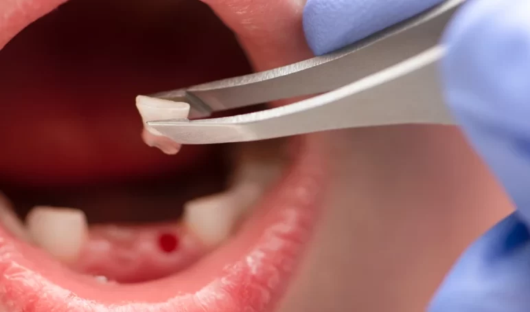 dental-clinic-in-preston dental-clinic-in-preston